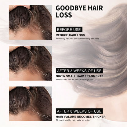 Hair Loss Treatment Serum 30Ml (Pack Of 2)